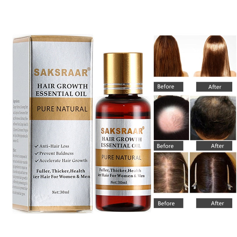 Essence Hair Loss Hair Growth 100% Authentic Essential Oil