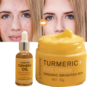 Organic Turmeric Acne Treatment Skin Lightening Cream and Oil